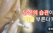 당신의 습관이 암을 부른다 줄여야 하는 7가지 식품